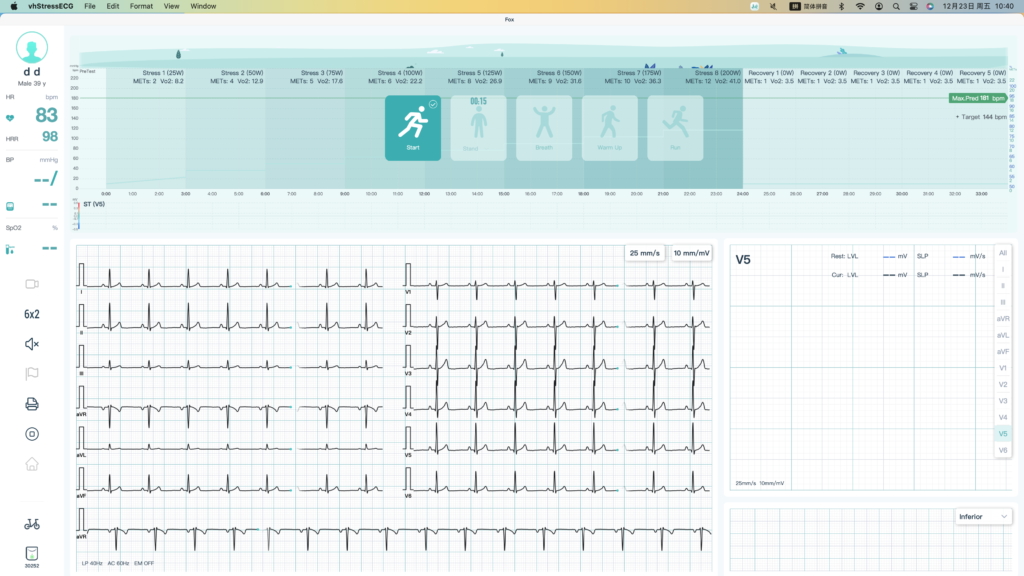 vhstressecg12 channel wireless bluetooth stress test ecg exercise ekg with ce and fda