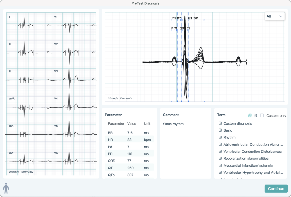 vhstressecg excellent performance 12 channel wireless bluetooth stress test ecg for mac os