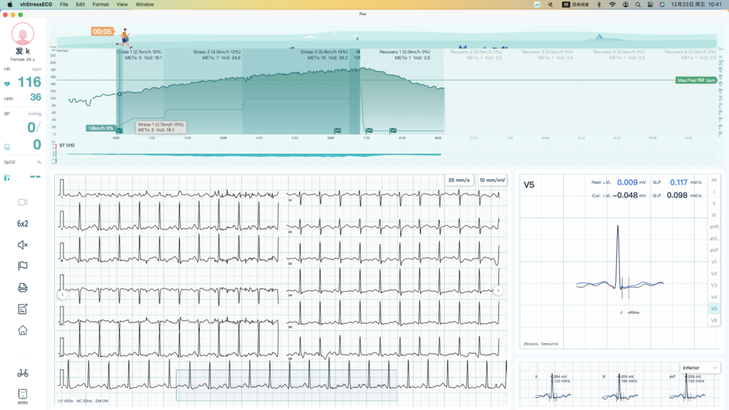 vhstressecg innovation 12 channel bluetooth stress test ecg for mac os