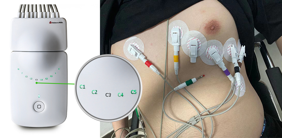 portable wireless bluetooth 12 channel electrocardiogram ecg ekg machine vhecg icv200s for ipad iphone