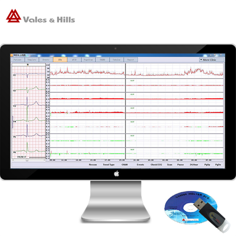ambuatory ecg device with 24 hours recording time holter ecg