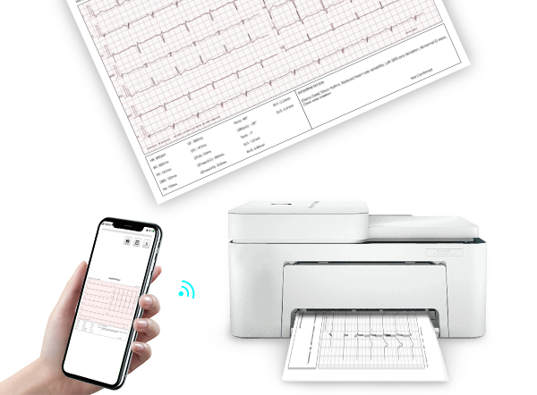 portable wireless bluetooth 12 channel electrocardiogram ecg ekg machine vhecg icv200s for ipad iphone