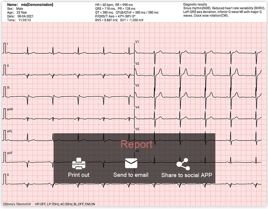 small size wireless bluetooth 12 channel smart ecg for android icv200