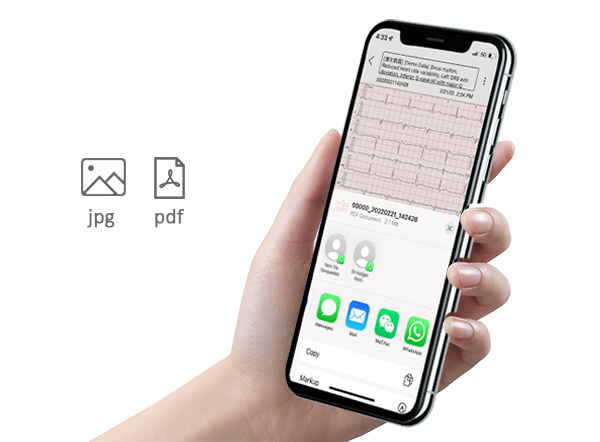 portable wireless bluetooth 12 channel electrocardiogram ecg ekg machine vhecg icv200s for ipad iphone