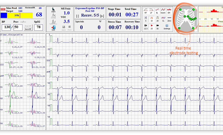 12 channel treadmill ergometer stress test ecg system with ce from manufacturer