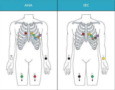 new version smart ecg device bluetooth connection for ios colorful recorders