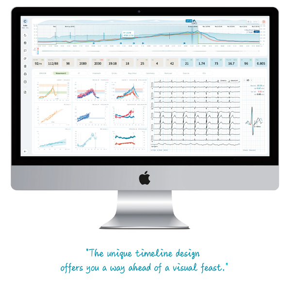 new design cardiopulmonary exercise test (cpet) based on imac with bluetooth connection