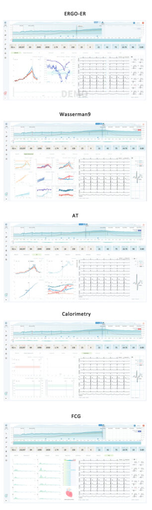 new design cardiopulmonary exercise test (cpet) based on imac with bluetooth connection